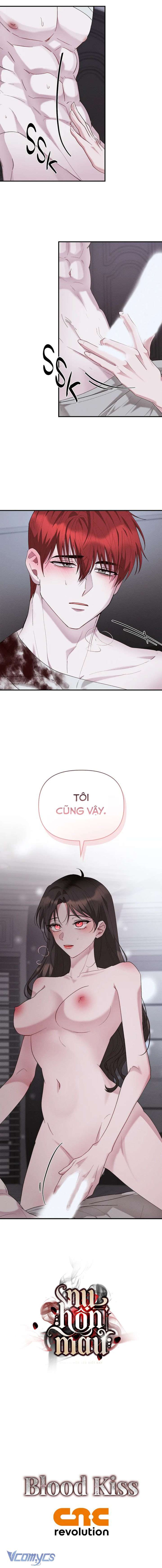 [18+] Nụ Hôn Máu 