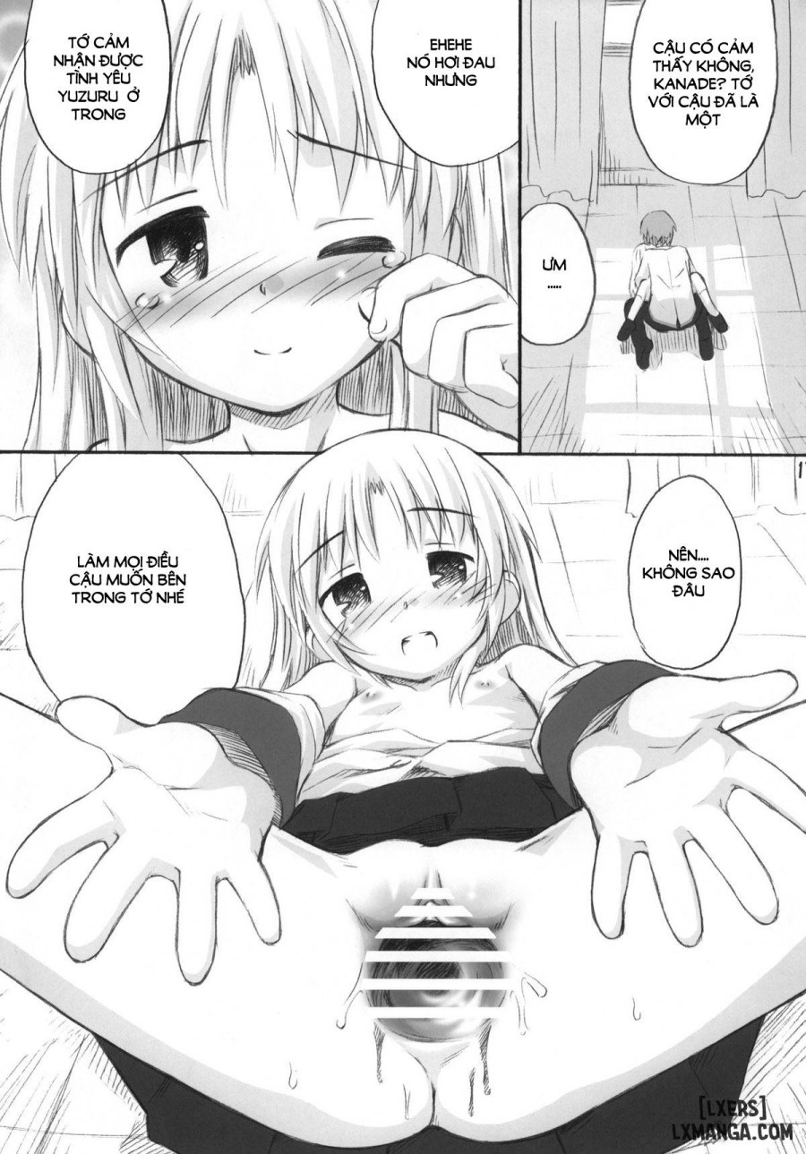 Kimi no Hitomi wa 100 Man Volt 