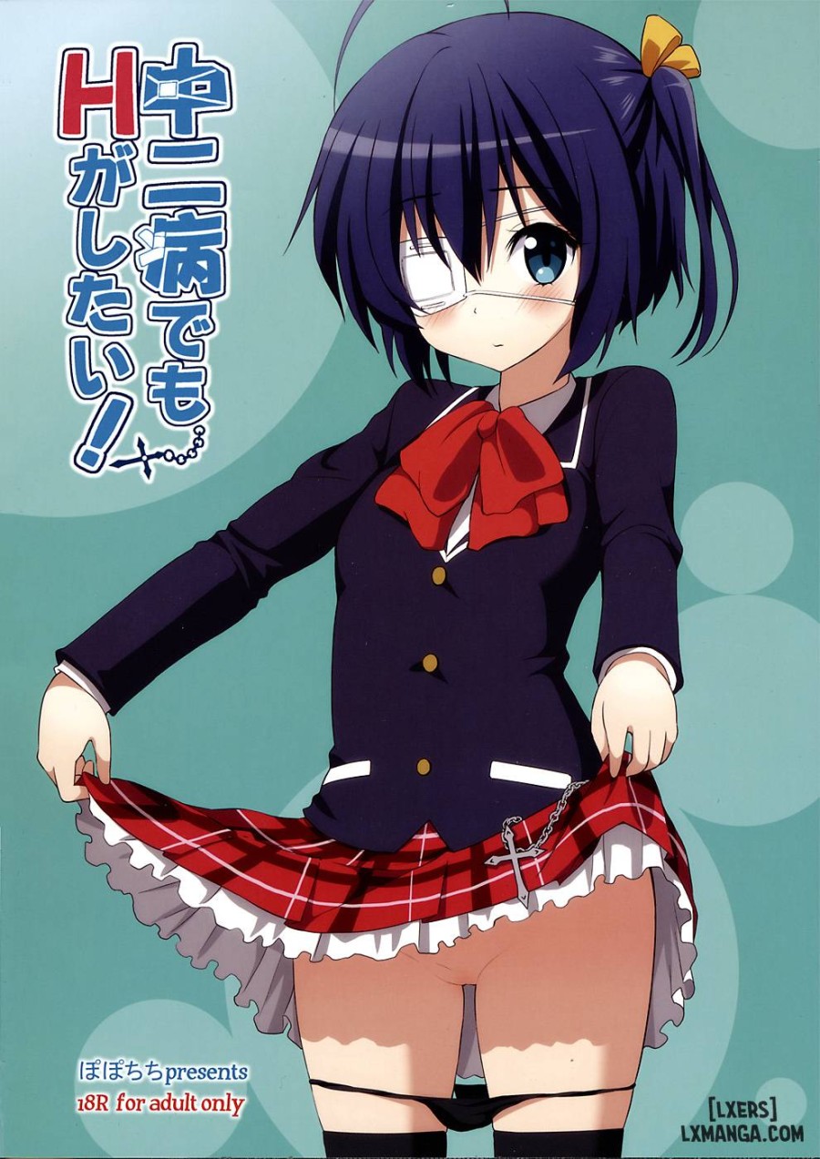 Chuunibyou Demo H ga Shitai 1 